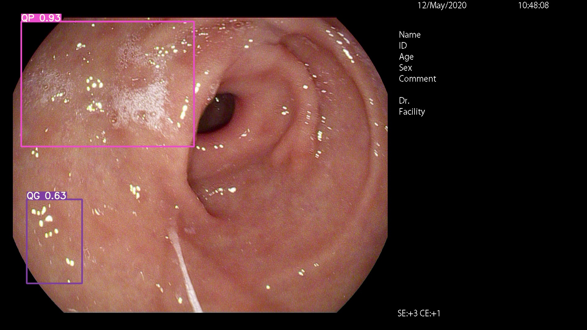 2020年4月1日 上午11:44 截图