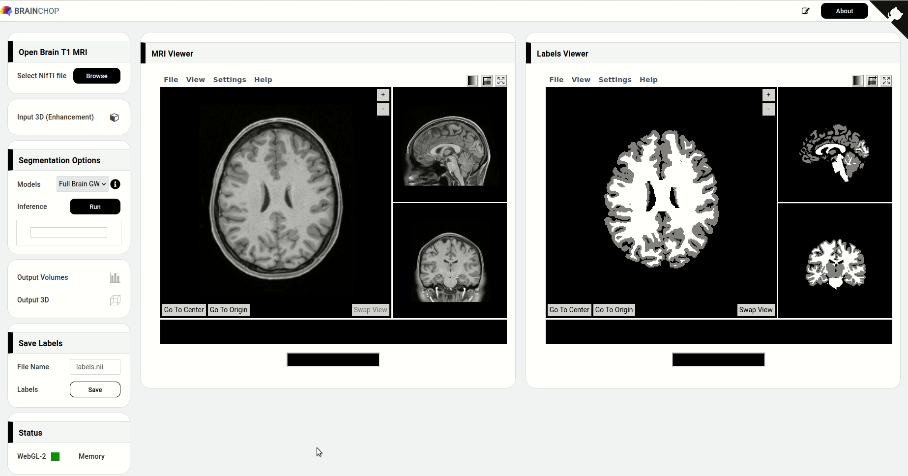 brainchop hero image