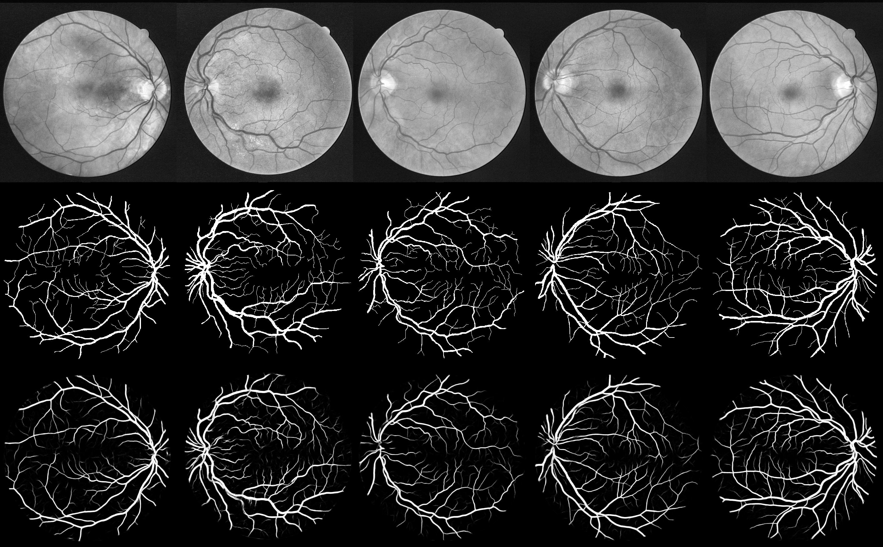 retina-unet hero image